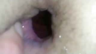 Gay anal fisting